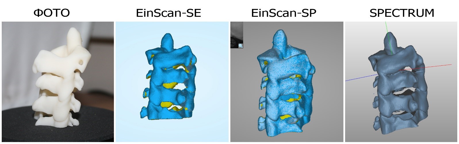 Сравнение сканирования 3D-модели позвонков сканерами Shining3D SE, SP и RangeVision Spectrum