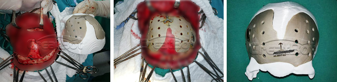Cranium_01.jpg Cranium_01.jpg