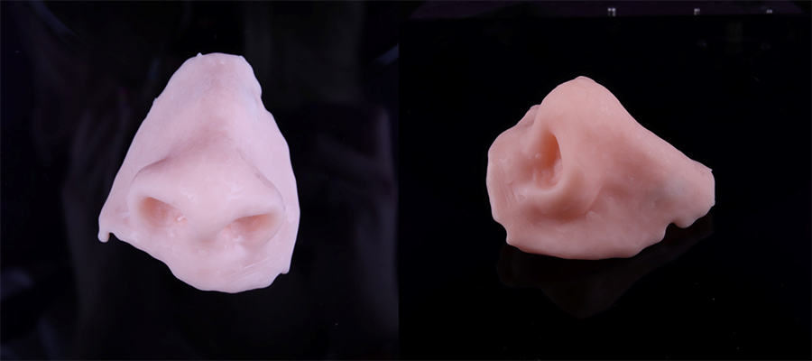 Использование аддитивных технологий в челюстно-лицевом протезировании4.jpg