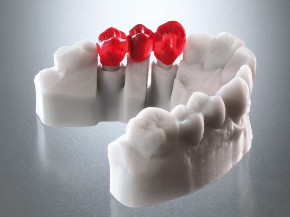 Коронки изготовленные из DETAX Freeprint cast UV